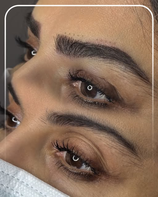 نمونه کاشت ابروی طبیعی 1