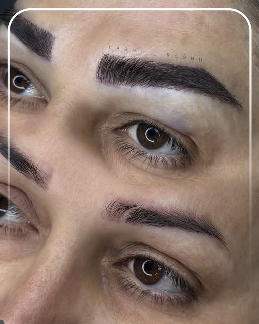 نمونه کاشت ابروی طبیعی 1