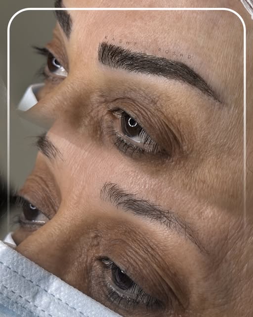 نمونه کاشت ابروی طبیعی 1
